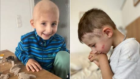 „Für immer Juli“: Julius (4) kämpft um seine letzte Chance gegen den Krebs