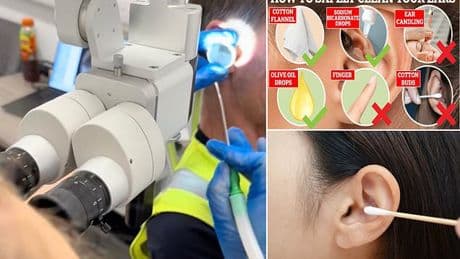Video captures moment of relief as huge nugget of wax is suctioned out of man's ear, restoring his hearing: 'It had been in there for years'