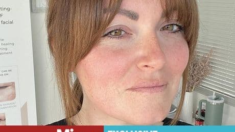 'Hairdresser saved my life after I took huge risk with my teen suntan obsession'