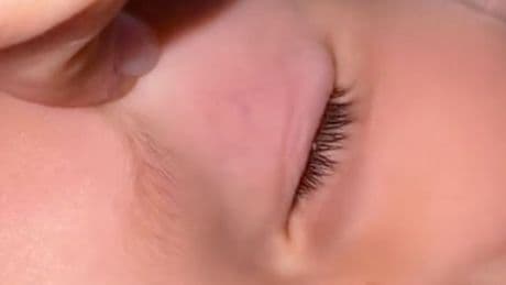 Mum makes 'weird' discovery on toddler's eye – then seconds later learns what it is
