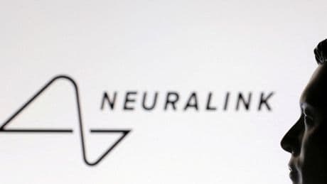 Neuralink e SLA: così Brad Smith è tornato a “parlare”