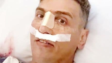 Burun ameliyatı sonu oldu