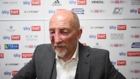 Iconic manager Ian Holloway suffers horror swelling on face after skin cancer scare as concerned fans send well wishes
