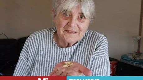 'I called NHS dentists for 7 years but couldn't get in, so I pulled all my teeth out'