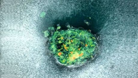 Erstmals live gefilmt! - Hier erobert ein Embryo die Gebärmutter