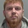 Vile boyfriend tried to bite out fiancée's eyeball and beat her unconscious after celebrating her pregnancy
