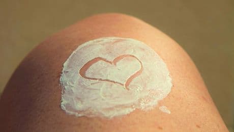 &quot;Más de tres quemaduras solares aumentan el riesgo de melanoma&quot;, advierten los dermatólogos