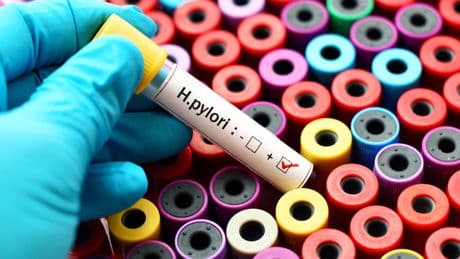 Qué es el helicobacter pylori, la bacteria que puede producir cáncer de estómago en más de 15 millones de niños