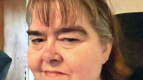 Monster mum's neglect led to son's legs needing amputated due to rotting