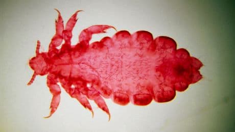 Toen mensen wollen kleding gingen dragen zag een akelige bacterie een nieuwe kans om zich te verspreiden