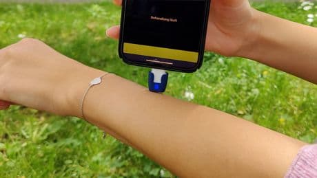 Schnelle Linderung nach Stichen: Stichheiler im Test
