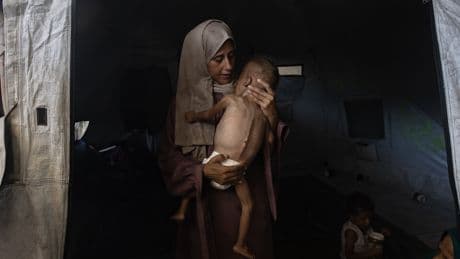 Gazans Are Dying of Starvation