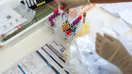 « L’accélération actuelle de l’épidémie de chikungunya à La Réunion peut évoquer la flambée de 2006 »