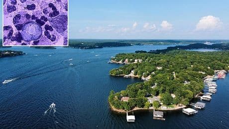 Swimmer contracts brain-eating amoeba spreading in water... are YOU at risk?