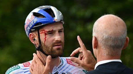 Stürze bei der Tour de France: „Wir sind heute durch die Hölle gefahren“