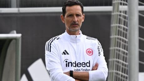 Eine Woche vor dem Start - Das sind Toppmöllers Eintracht-Baustellen