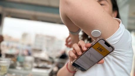 La fiebre del sensor continuo de glucosa entre los no diabéticos