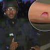 Good Morning Britain presenter SHOT while reporting live from Los Angeles protests and left with injury that 'felt like a tonne of bricks crushing arm'