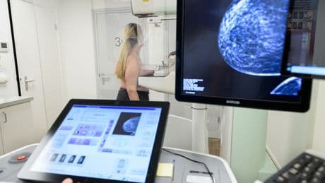 'Doorbraak voor borstkankerpatiënten': arts beslist voortaan over borstreconstructie