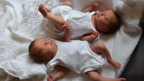 Genetik mi çevre mi? Tek yumurta ikizlerinin paylaştığı ilginç özellikler