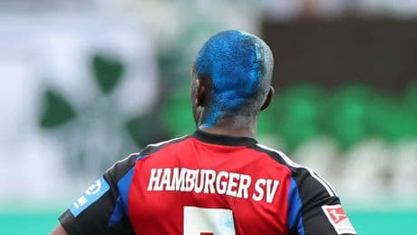 HSV-Franzose mit schräger Frisur - Glatzel verrät Dompés Haar-Geheimnis