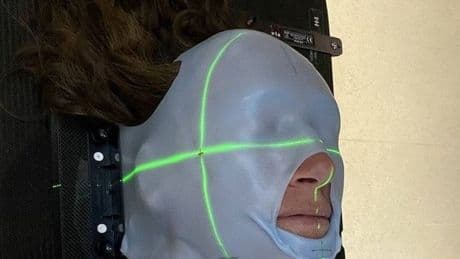 'I thought snoring was a blocked nose - it was sign of skull-eroding disease'