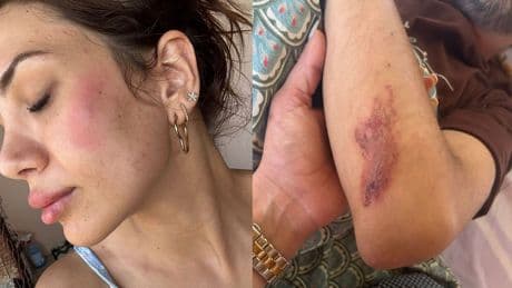 Vahşetin böylesi: Evinin önündeki köpekleri besleyen veteriner darp edildi
