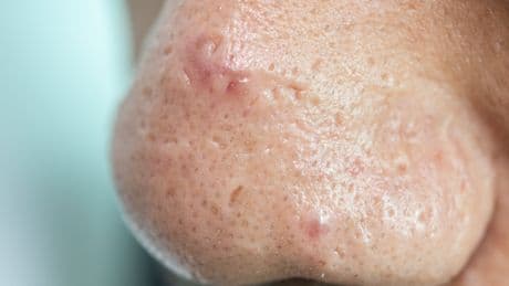 This Common But Gross Habit Could Land You In Hospital