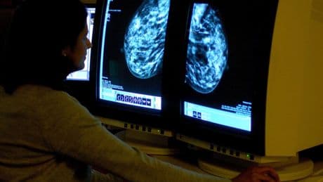 ‘Huge breakthrough’ as breast cancer pill approved for NHS