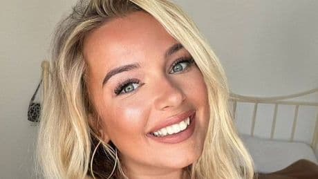 'I bought shorts on TikTok - they left me with second-degree burns'