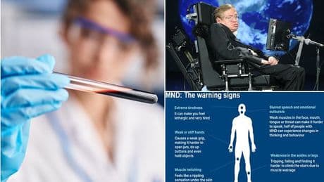 Breakthrough test could spot deadly motor neurone disease years before symptoms appear