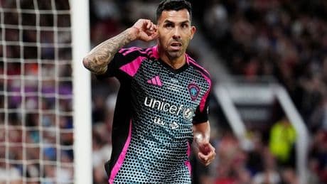 Angry Ginge tears into Carlos Tevez after Soccer Aid as he shows off bloody injury