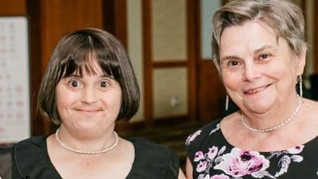 Canadians with Down syndrome live until 60 on average, study finds