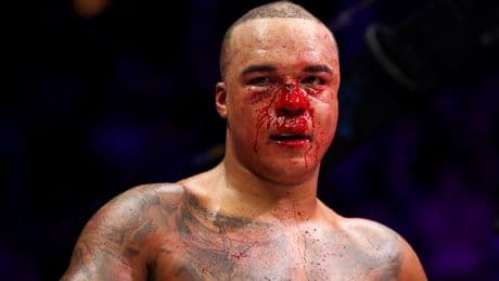 ‘It took years off my life’ – Fabio Wardley lived off ice cream and noodles after brutal Frazer Clarke fight