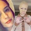 Woman left with severe burns on 70 percent of her body and had eight fingers amputated after volcano eruption reveals what she looks like 5 years later
