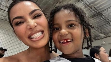 Celebrity dentist warns of tooth art danger after Kim Kardashian's tooth fairy post