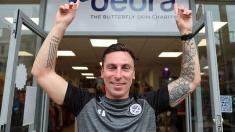 Celtic icon Scott Brown and Rangers legend Graeme Souness back campaign fighting painful skin disease