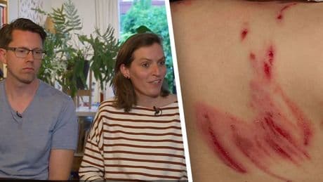 Eltern sprechen über Raubtier-Angriff - Ein Wolf hat unseren Sohn so zugerichtet