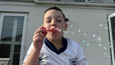 Drug trial for severe epilepsy has transformed children’s lives, families say