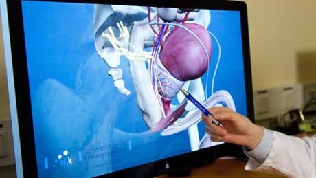 Prostatavorsorge: Früherkennung mit Fingerspitzengefühl und PSA-Test