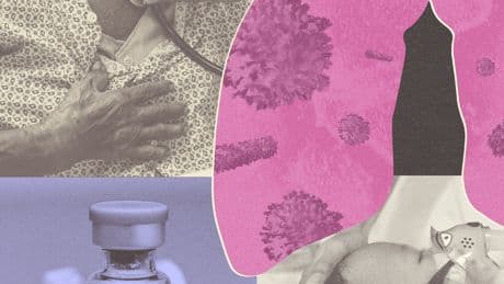 R.S.V. Season Is Approaching. Here’s How to Protect Yourself.