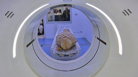 Il Museo di Archeologia ligure e la storia delle mummie ai raggi X