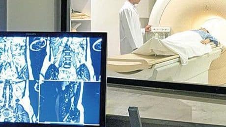 Üç kanser türü daha tarama kapsamına alınıyor