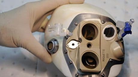 Carmat, l’entreprise française qui fabrique des cœurs artificiels temporaires, se déclare en cessation de paiements