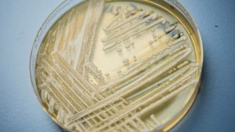 Candidozyma auris: Infektiöser Pilz breitet sich in Europa aus - wie gefährlich ist das?