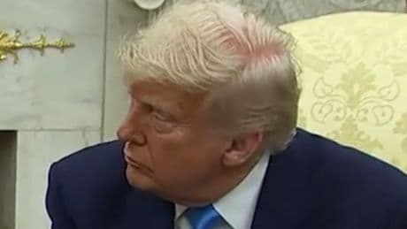 Trump’s bald spot during Oval Office meeting draws laughter on social media