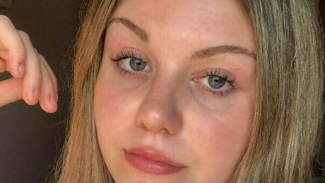 Nausea, stanchezza, poi il malore in treno: Eleonora Chieregato muore a 17 anni per una malattia autoimmune. I primi sintomi ad aprile