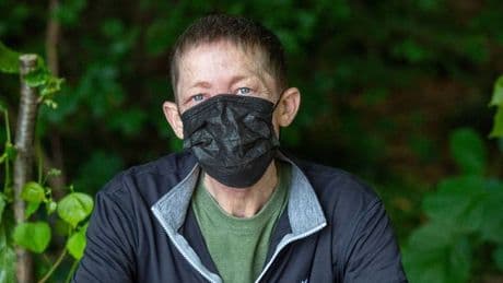 Scots man who complained of 'sore nose' left with hole in face after cancer diagnosis