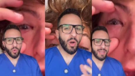 Jorge Martín, médico y enfermero: ''Si te levantaste con los ojos pegados, no es solo sueño, ¡podrías tener una conjuntivitis bacteriana!''