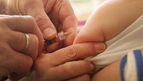Where measles cases are surging across England